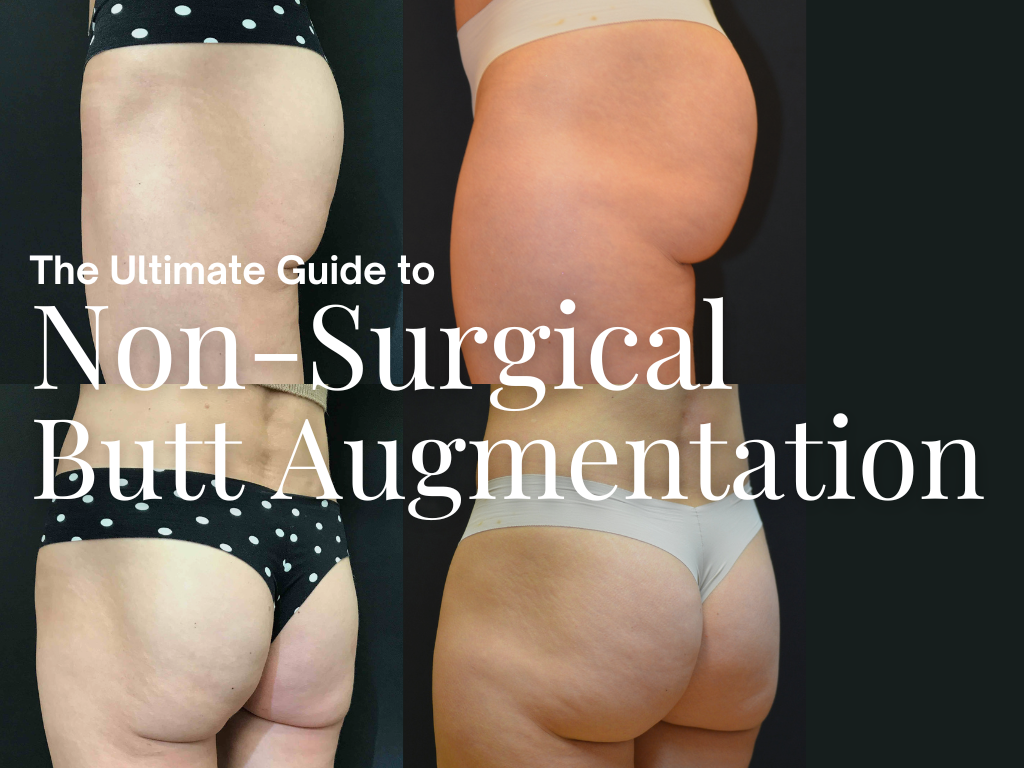 Ultimate Guide: Non-Surgical Body Contouring